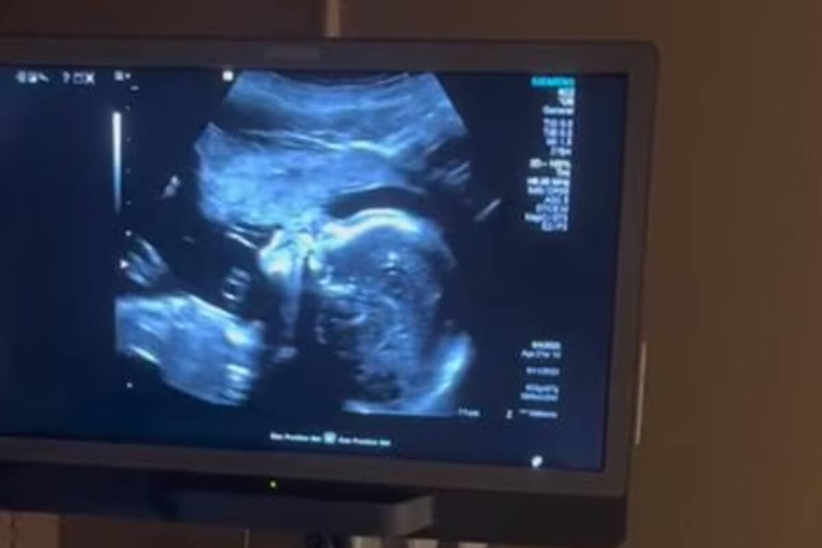 El video muestra la gran conexión que tiene una madre embarazada con su bebé