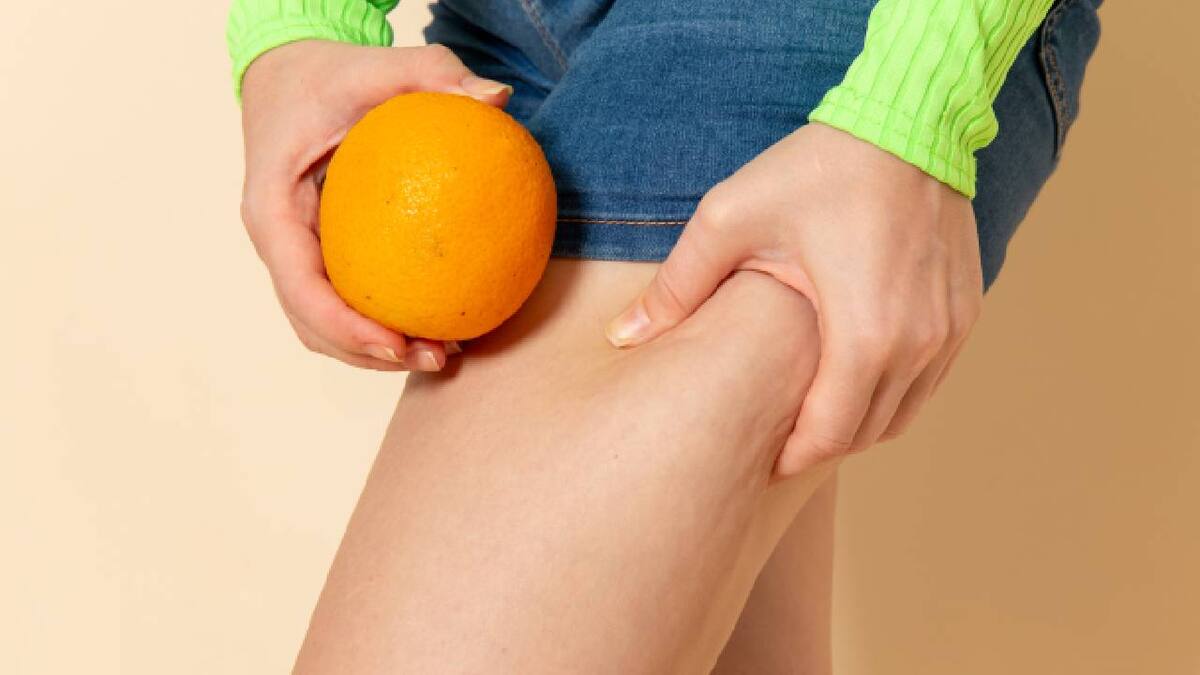 Termina con la piel de naranja con este remedio natural (Foto: Freepik)