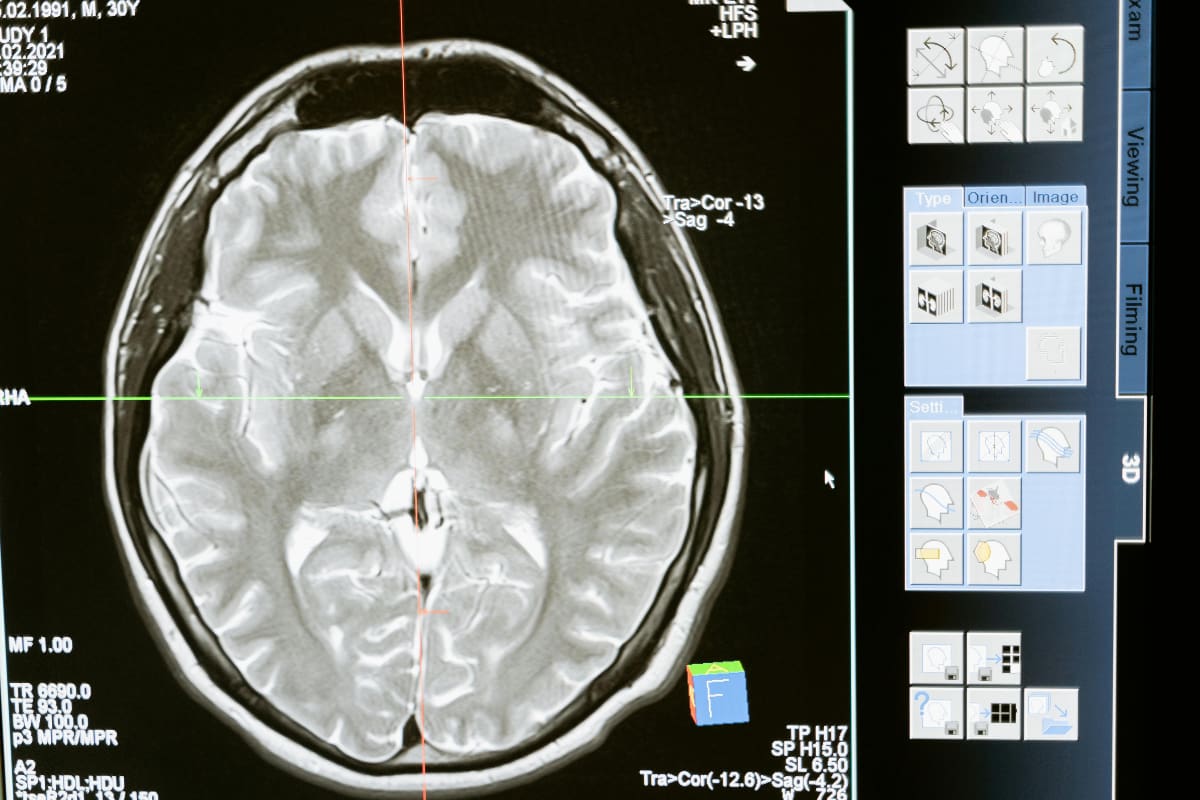 Mediante resonancias magnéticas, los expertos lograron descubrir cómo cambian los cerebros de quienes pasan prolongados periodos de tiempo en el Espacio.