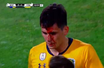 Alfonso Parot quedó sangrando tras recibir fuerte golpe en la Superacopa Argentina