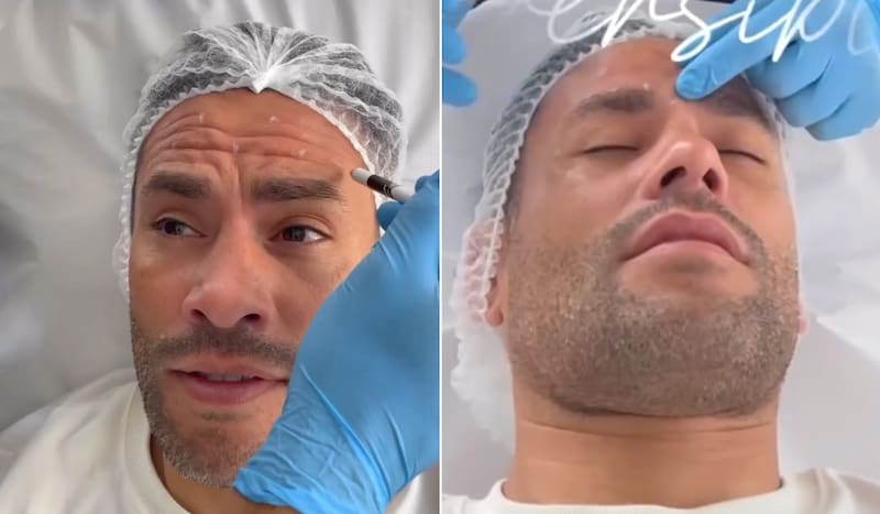 Claudio Valdivia y su procedimiento estético.