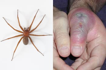 Cómo reconocer si una araña es de rincón y qué hacer si te muerde
