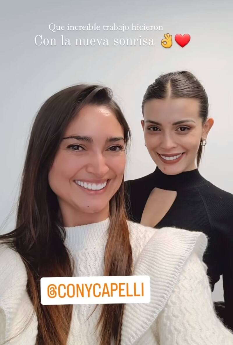 Constanza Capelli apostó por las carillas de porcelana. Créditos: Instagram
