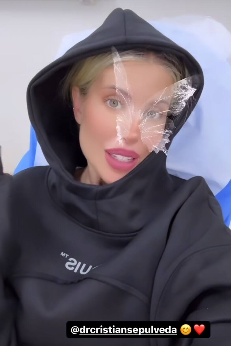Coté López se sometió a mismo procedimiento estético que Kim Kardashian.