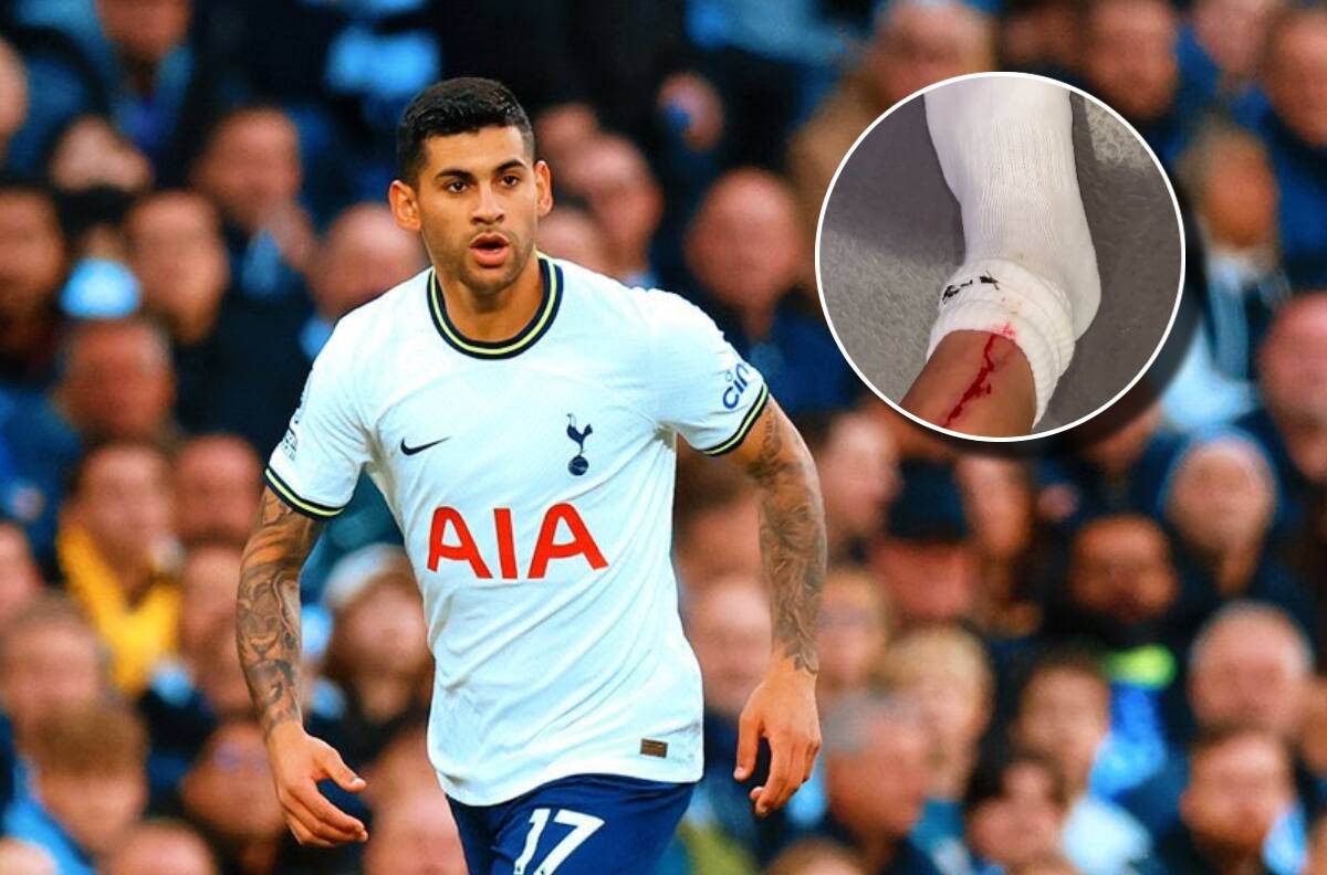 VIDEO | Cuti Romero le abrió la pierna a un compañero del Tottenham en la pretemporada