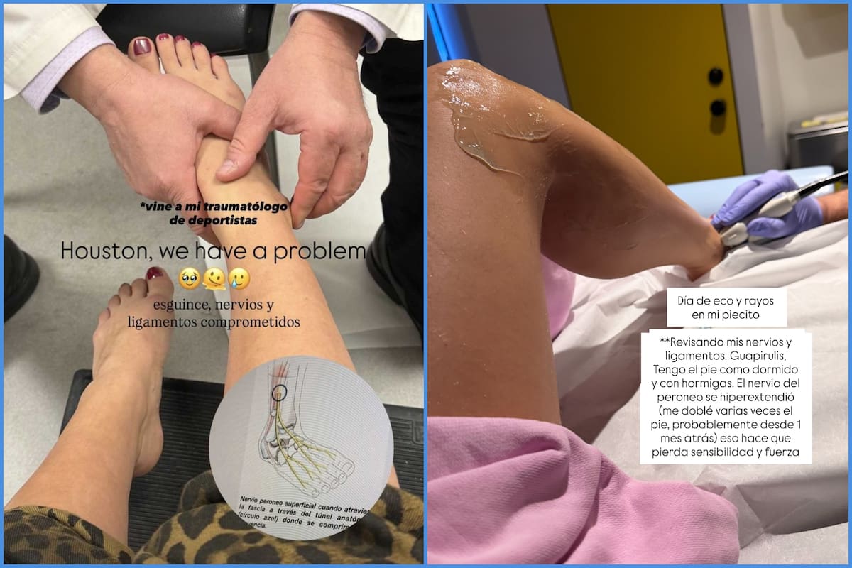 La influencer encendió las alarmas tras revelar un inesperado compromiso neurológico en su pie que le impide ensayar. Foto: Instagram.