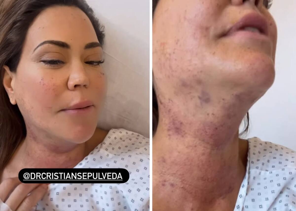 Daniella Campos se operó de un problema de bocio.