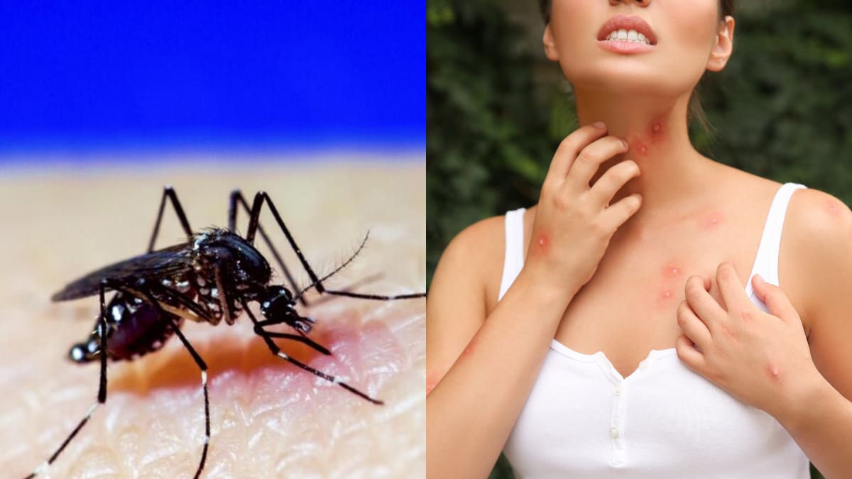 Dengue en Chile: Estas son las recomendaciones del Minsal para evitar contagios