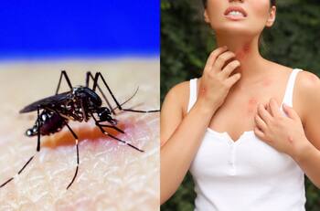 Dengue en Chile: Estas son las recomendaciones del Minsal para evitar contagios