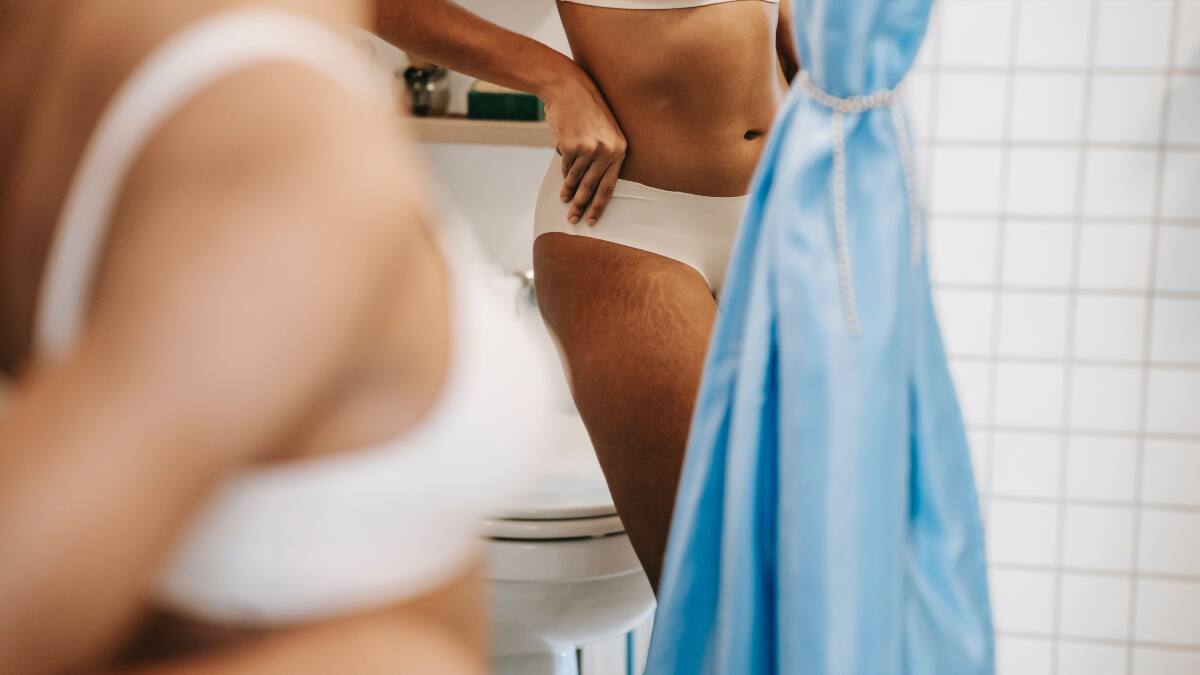 Cloaking: La novedosa técnica de belleza que te ayudará a disimular las estrías