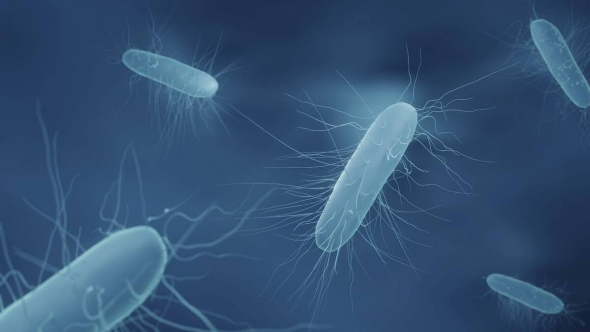 con presencia de Listeria fueron detectados en queso de cabeza de la marca San Pablo.