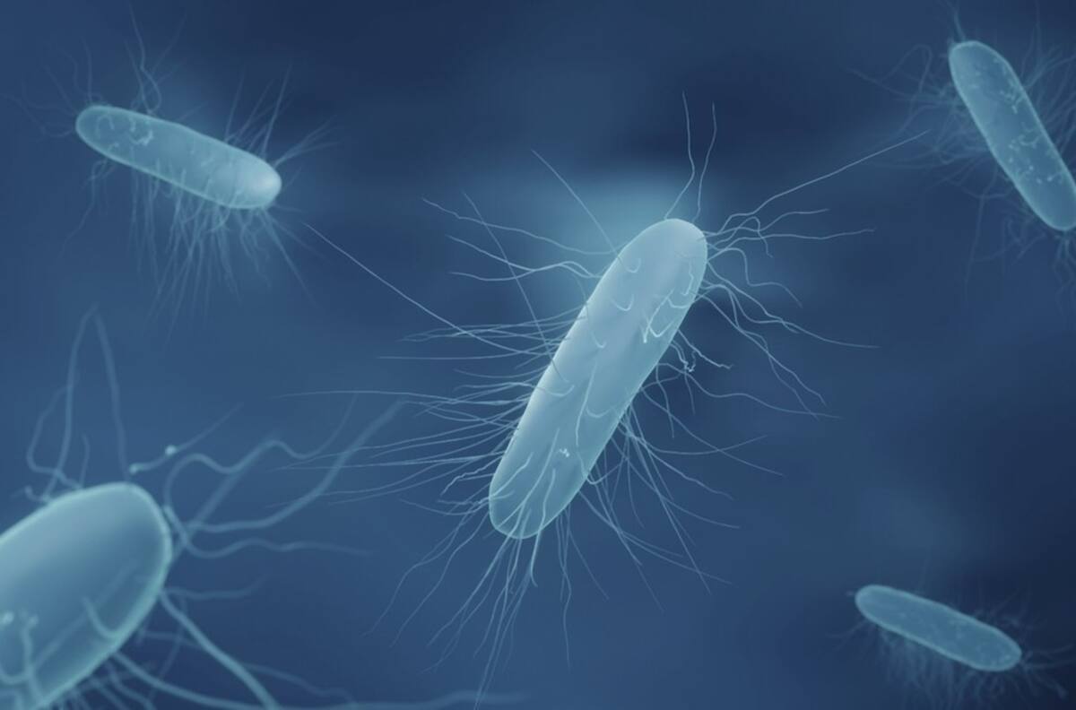 Siete regiones se encuentran bajo alerta alimentaria por brote de listeria detectado en queso de cabeza