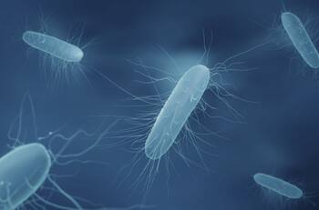 Siete regiones se encuentran bajo alerta alimentaria por brote de listeria detectado en queso de cabeza