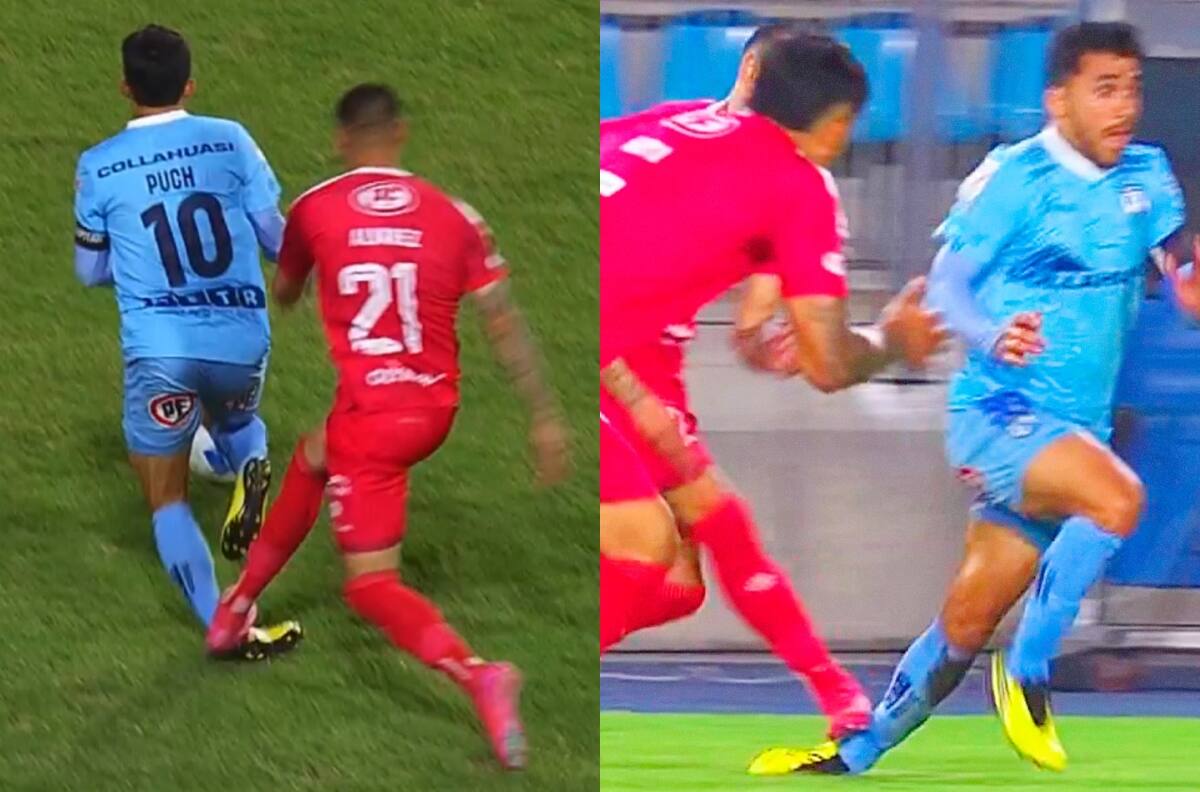 Sufre Deportes Iquique: así quedó el tobillo de Edson Puch tras criminal infracción