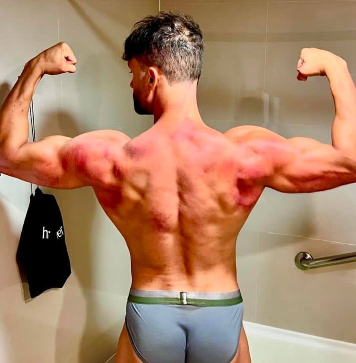 terminó con varias heridas tras la final. Créditos: Instagram