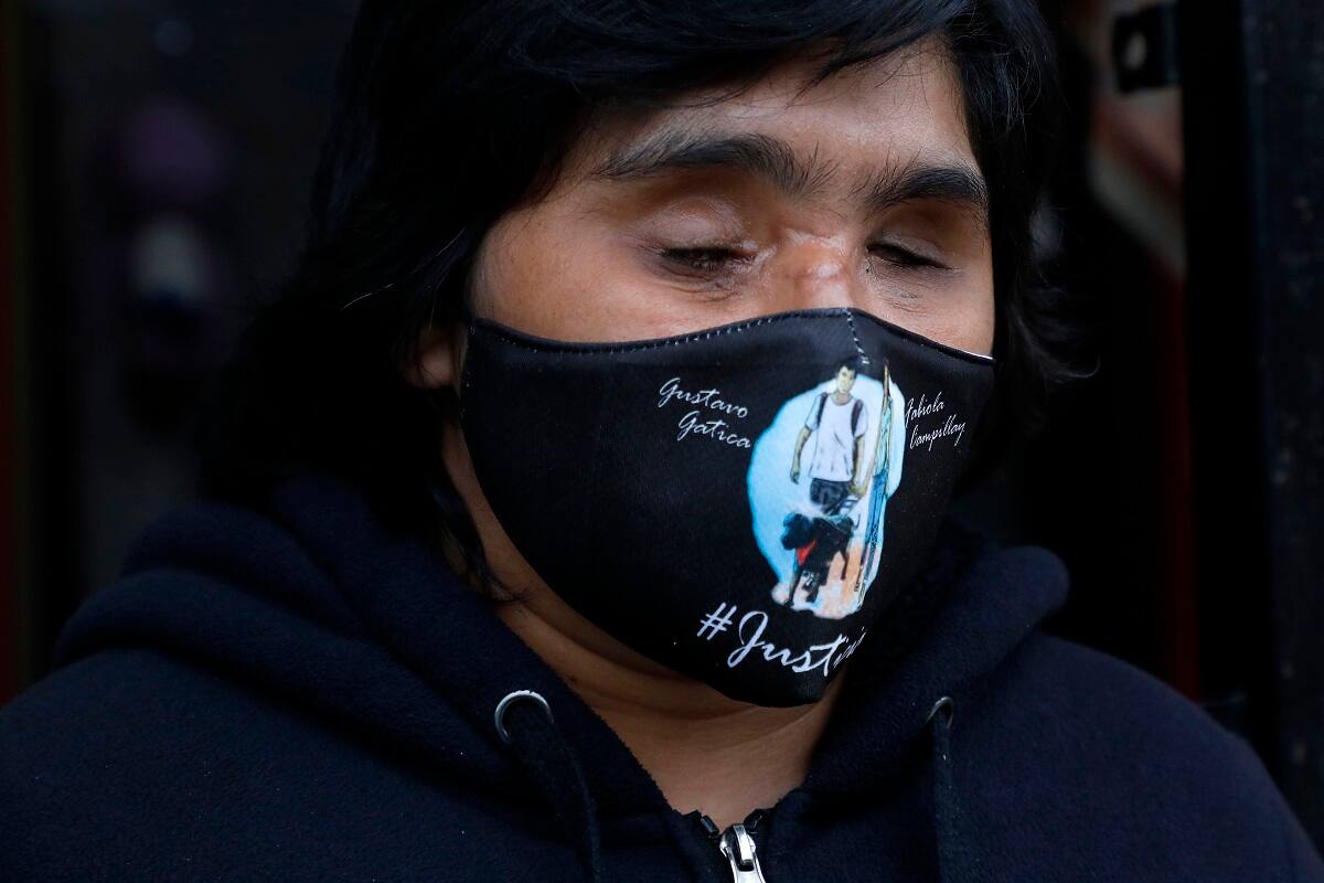 San Bernardo, 28 de agosto de 2020.
Fabiola Campillai es fotografiada en su domicilio durante la jornada en que un excarabinero fue detenido por su supuesta participacion en el impacto con una bomba lacrimogena ocurrido el pasado 26 de noviembre que le costo la vision y otras secuelas fisicas y sicologicas.
Andres Pina/Aton Chile