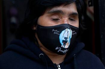 Fabiola Campillai fue internada para ser operada por daño en su cráneo