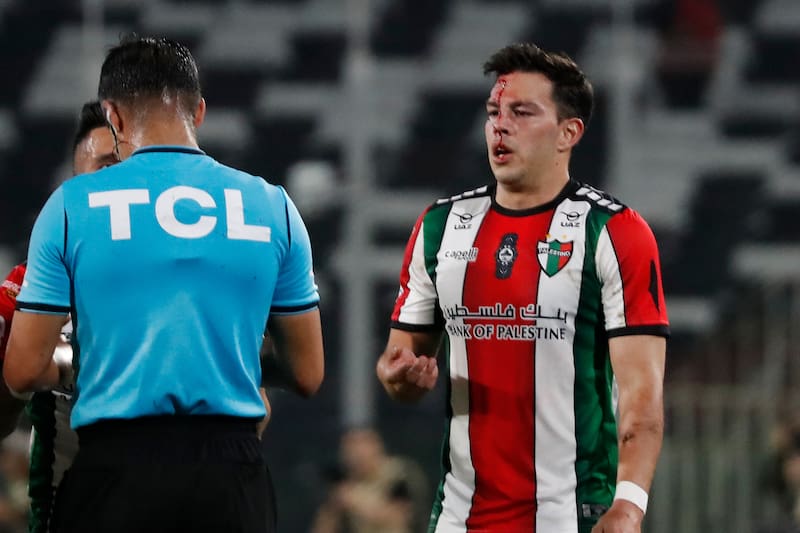 El defensa de Palestino tuvo una leve hemorragia tras recibir una fuerte patada en su rostro en la semifinal de Copa Chile ante Colo Colo. (Foto: Agencia Aton)