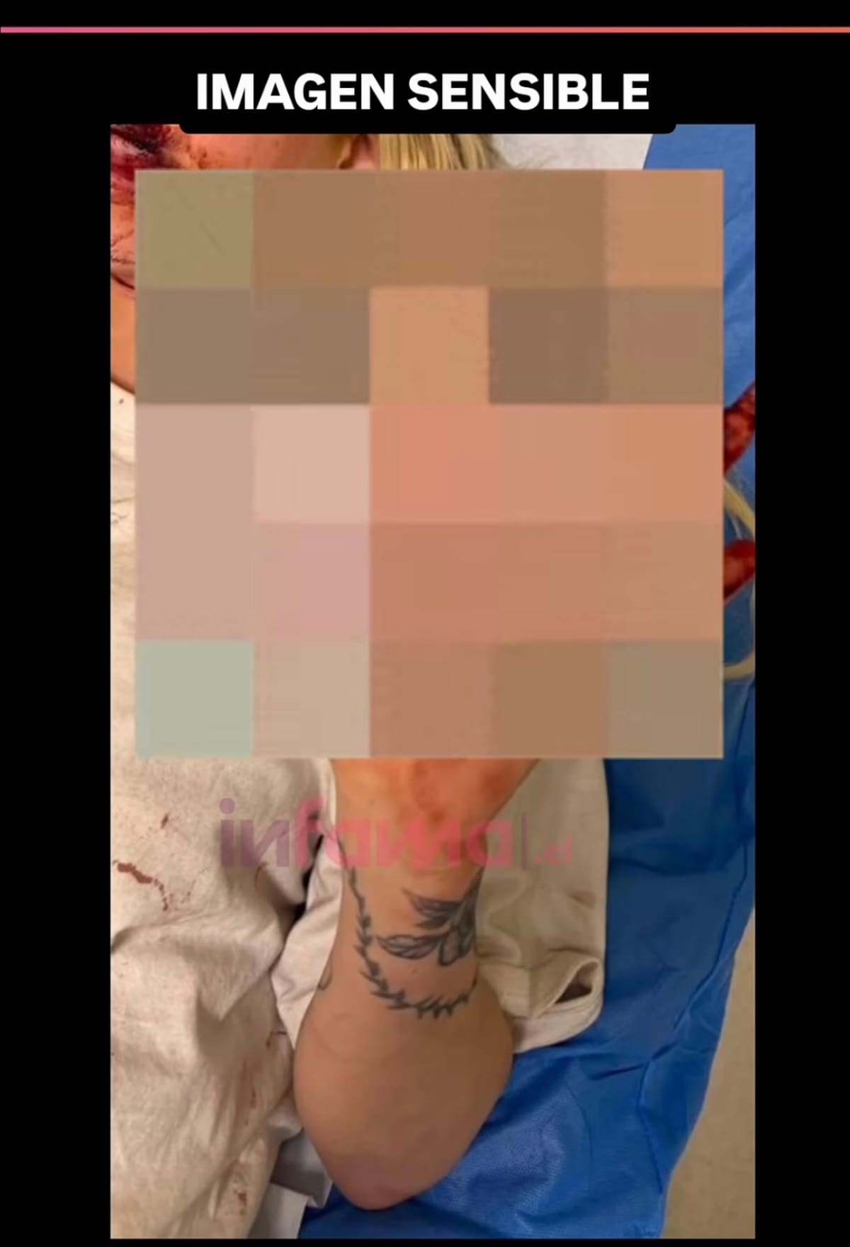 La cantante urbana habría sido golpeada.