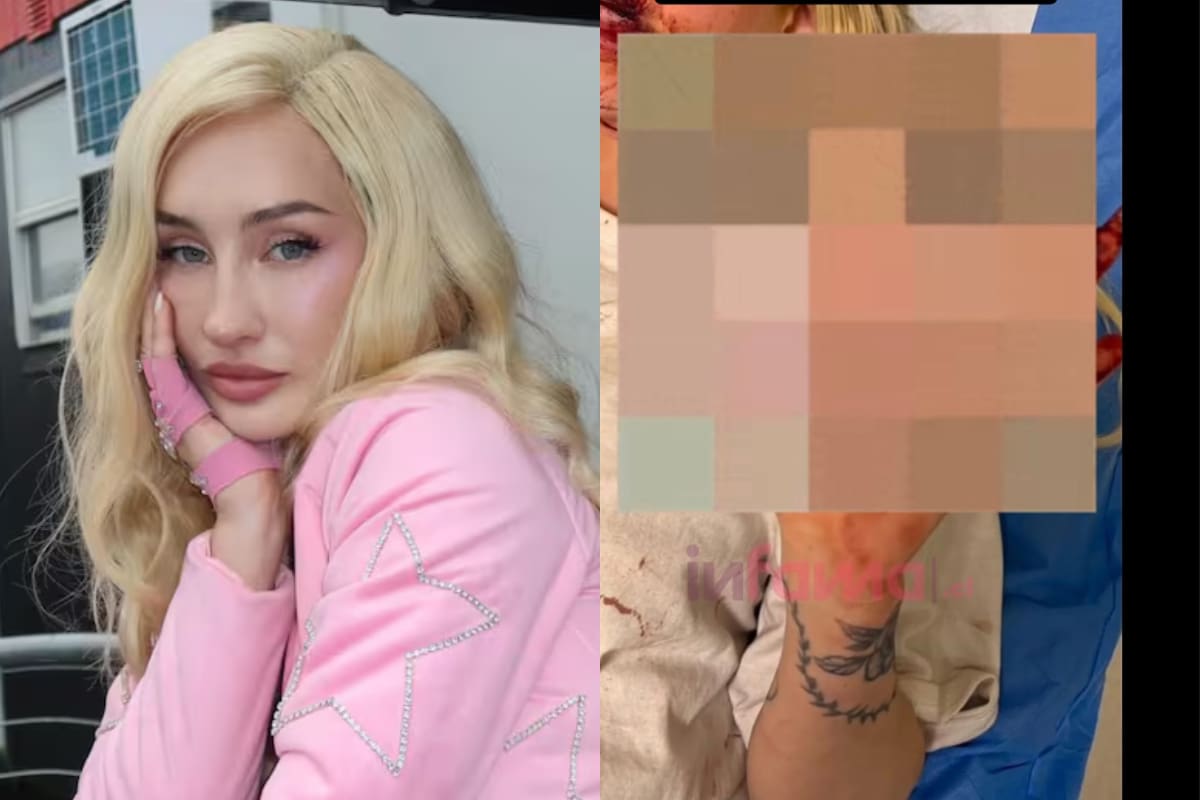 Actualizan estado de salud de la cantante tras sufrir brutal golpiza.