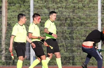 Caos en el fútbol chileno: partido terminó con árbitro ensangrentado y barricadas fuera del estadio