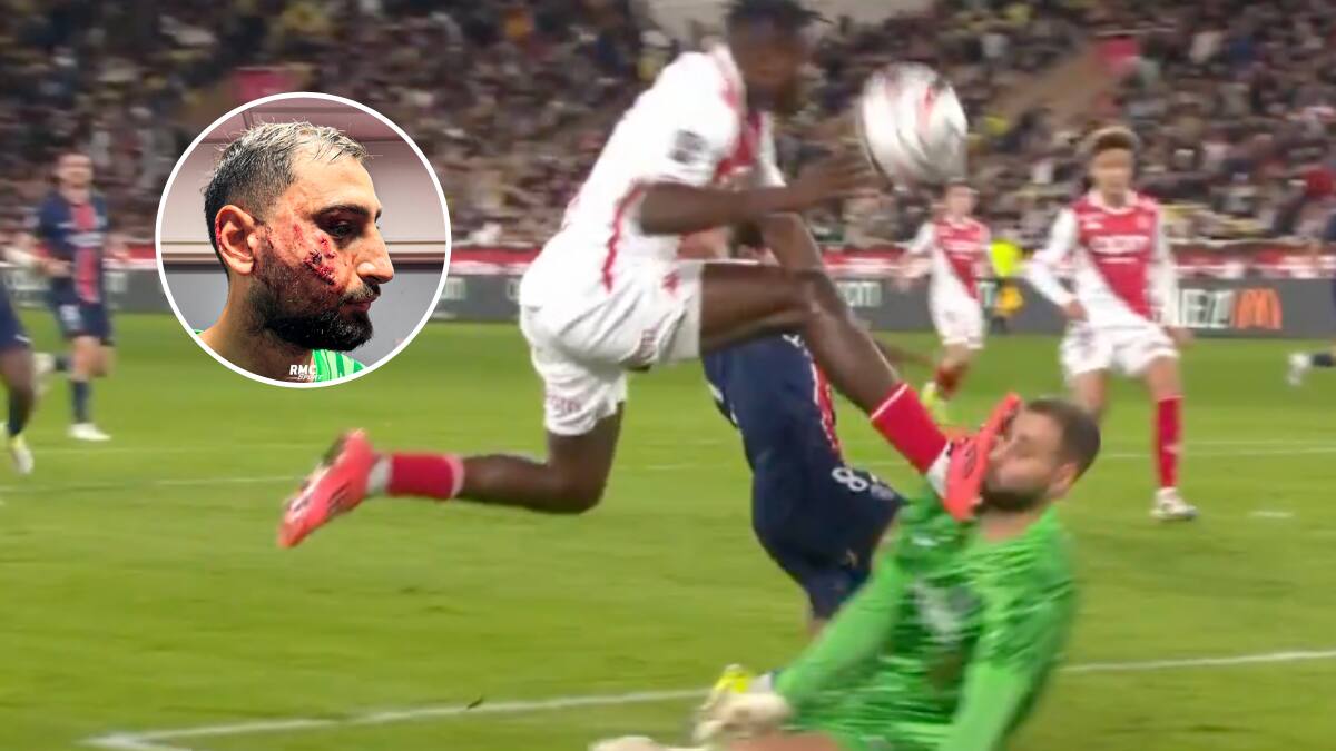 La impactante patada en la cara que recibió Donnarumma en Francia: no pudo seguir jugando