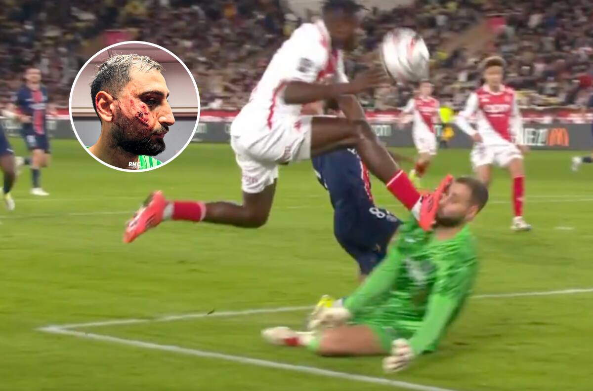 La impactante patada en la cara que recibió Donnarumma en Francia: no pudo seguir jugando