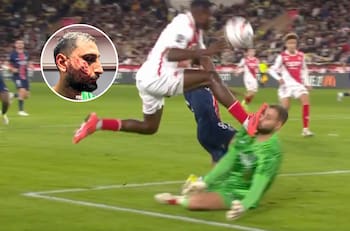 La impactante patada en la cara que recibió Donnarumma en Francia: no pudo seguir jugando