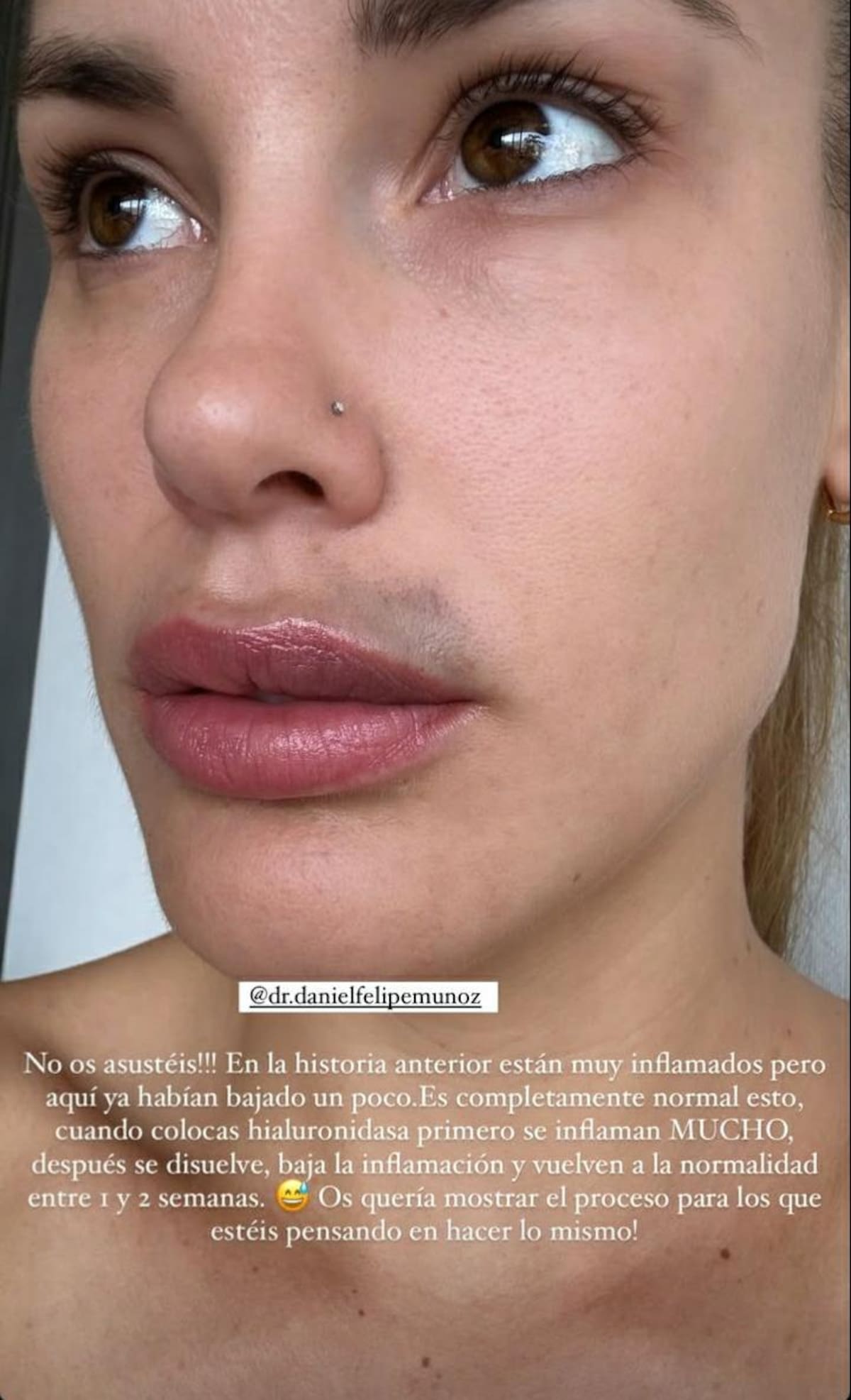 sube historia sobre la evolución de sus labios.