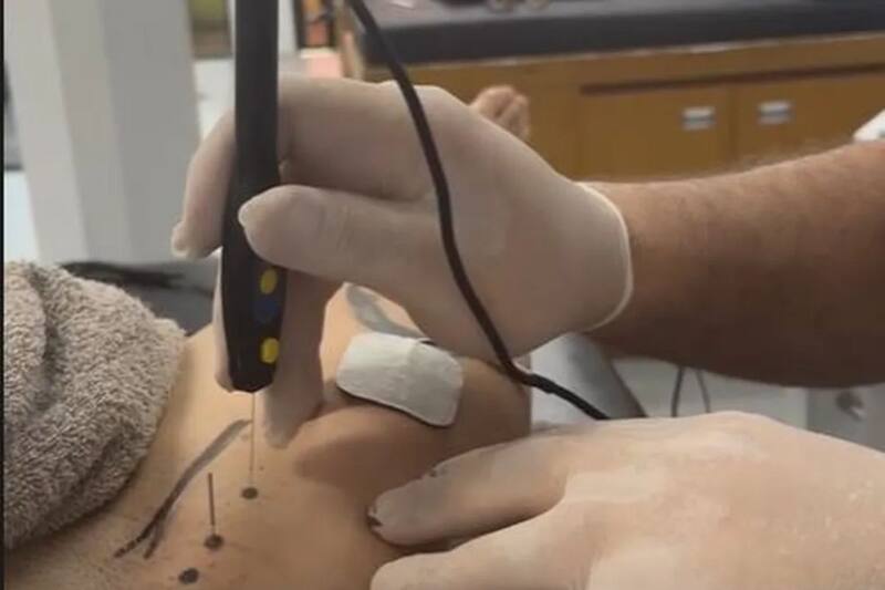 Imágenes del tratamiento al que se somete Gary Medel.