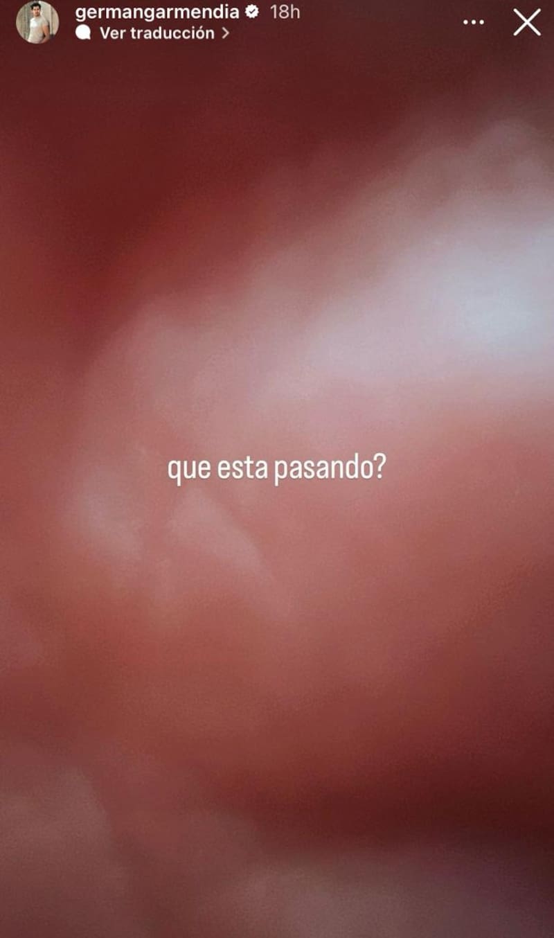 Germán Garmendia reaccionó ante pérdida de millones de seguidores.