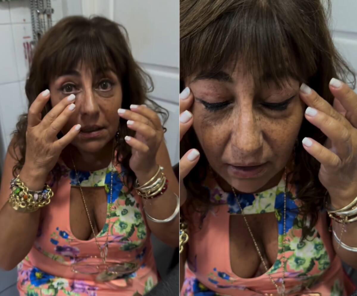 Helhue Sukni y el avance de su intervención estetica.