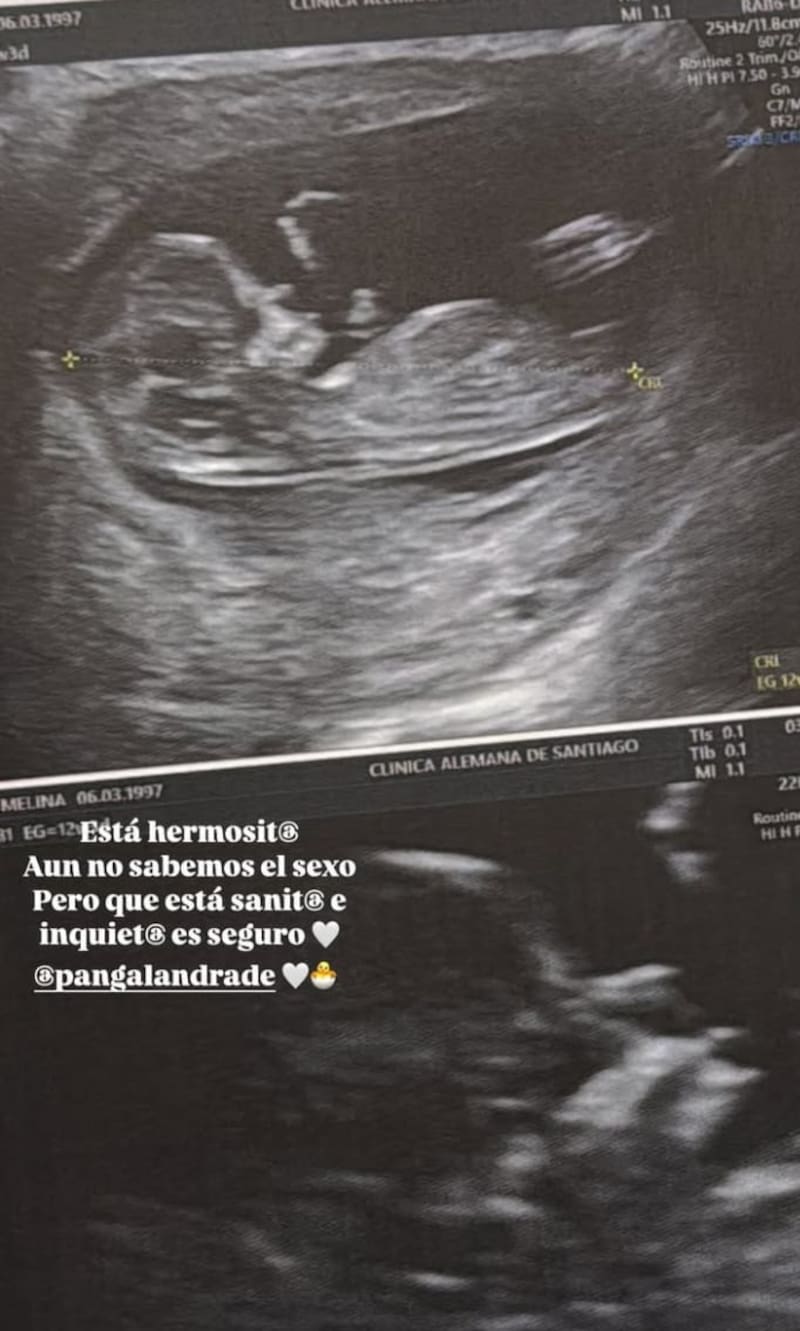La modelo mostró como crece su bebé. Créditos: Instagram