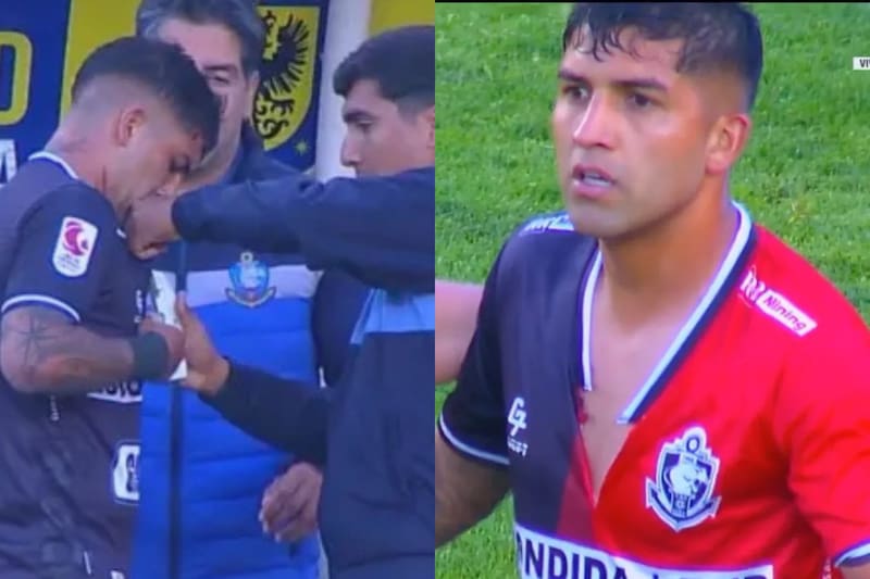 Le tuvieron que corchetear la polera.