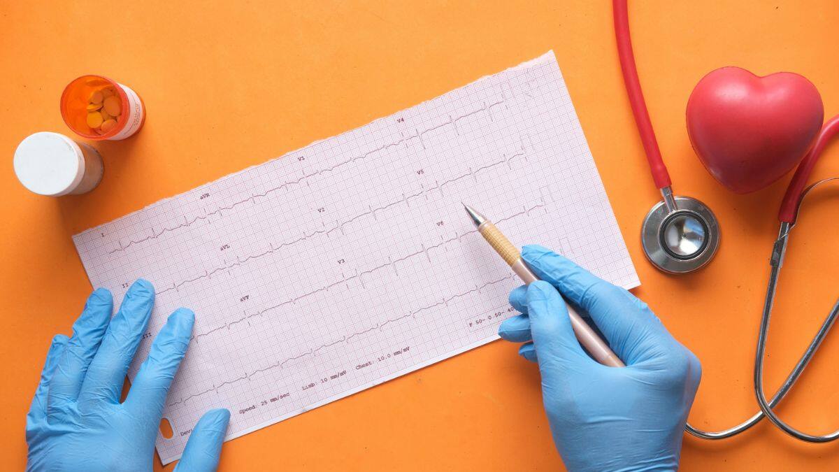 Raúl Saued, cardiólogo: “Estamos viendo un alza en casos de infartos, incluso en pacientes más jóvenes”