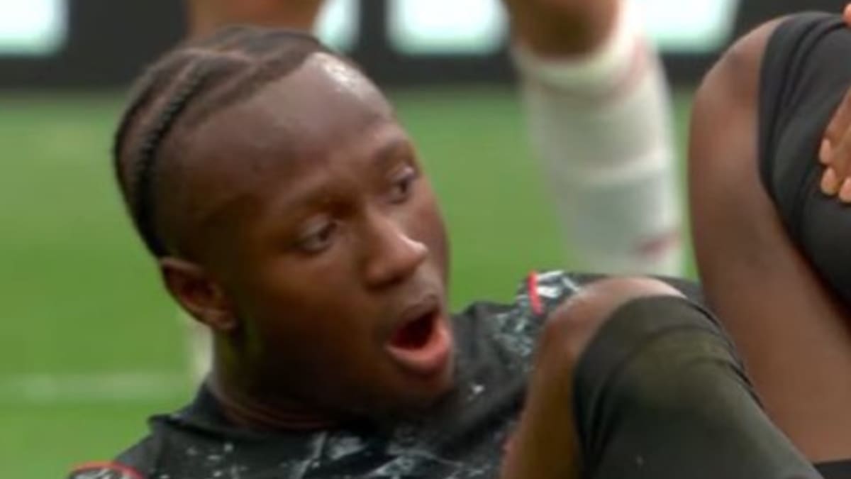 VIDEO | Terrible: jugador de Canadá se quebró la pierna y así reaccionó el arbitro chileno Cristián Garay