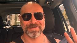 ¿Cuánto cuesta el procedimiento estético de implante capilar que se realizó José Antonio Neme?