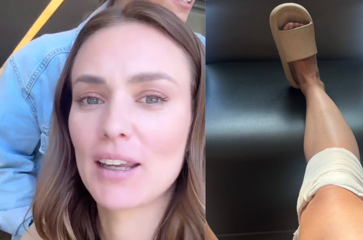 “Muy mala suerte”: Kika Silva terminó en la clínica tras sufrir grave accidente doméstico