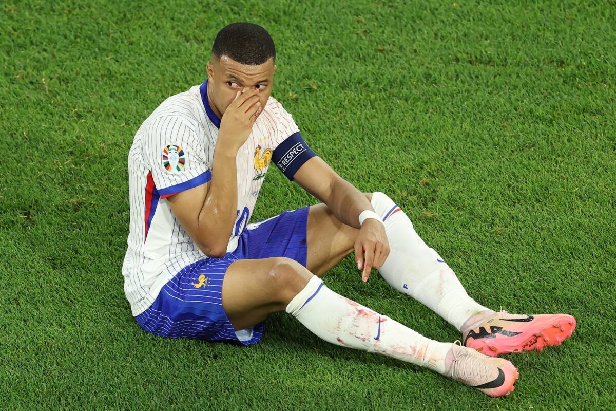 sufrió una fuerte lesión en la Eurocopa. EFE