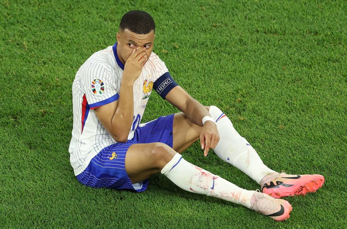 Los tiempos complican a Kylian Mbappé tras su fractura nasal