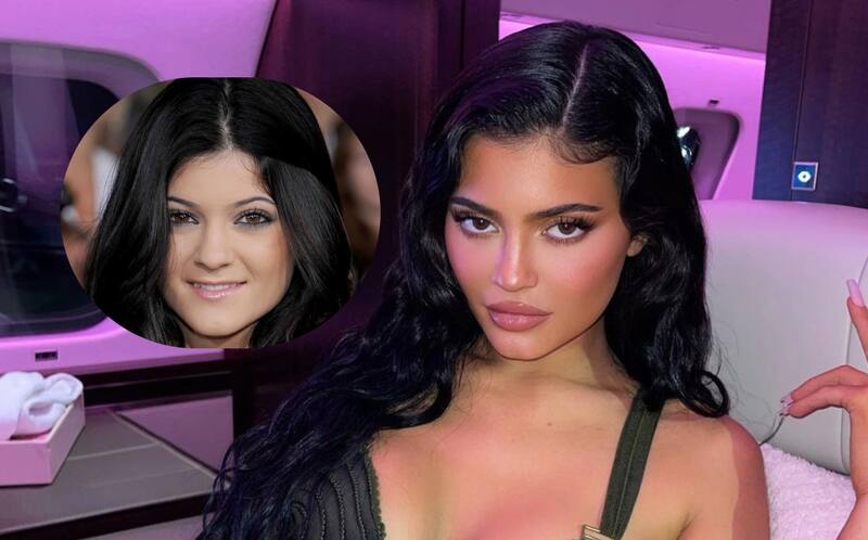 Antes y después de la socialité