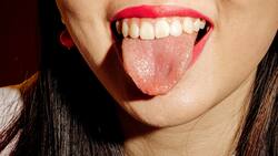 El color de tu lengua puede indicarte si hay problemas en tu salud