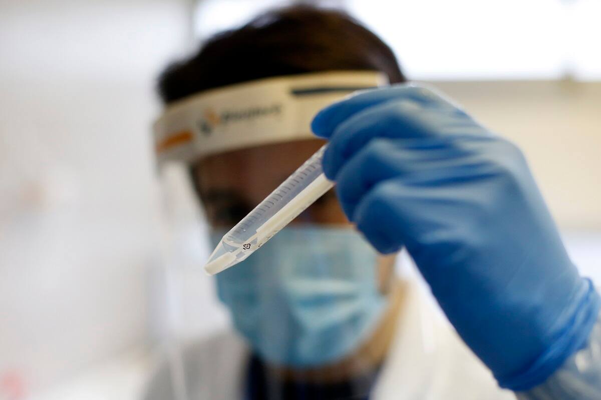 Valparaiso, 22 de junio 2020
El laboratorio COVID-19 de la Universidad de Playa Ancha, instalado en el Centro de Investigacion HUB Ambiental de la UPLA, inicia sus funciones y fue designado por la Secretaria Regional Ministerial de Salud como centro de referencia regional para futuros centros de diagnostico. Para tal efecto su personal capacitado, bajo estrictos procedimientos y protocolos de bioseguridad, ya trabaja con las primeras muestras respiratorias entregadas por el Servicio de Salud Valparaiso-San Antonio.
Raul Zamora/Aton Chile