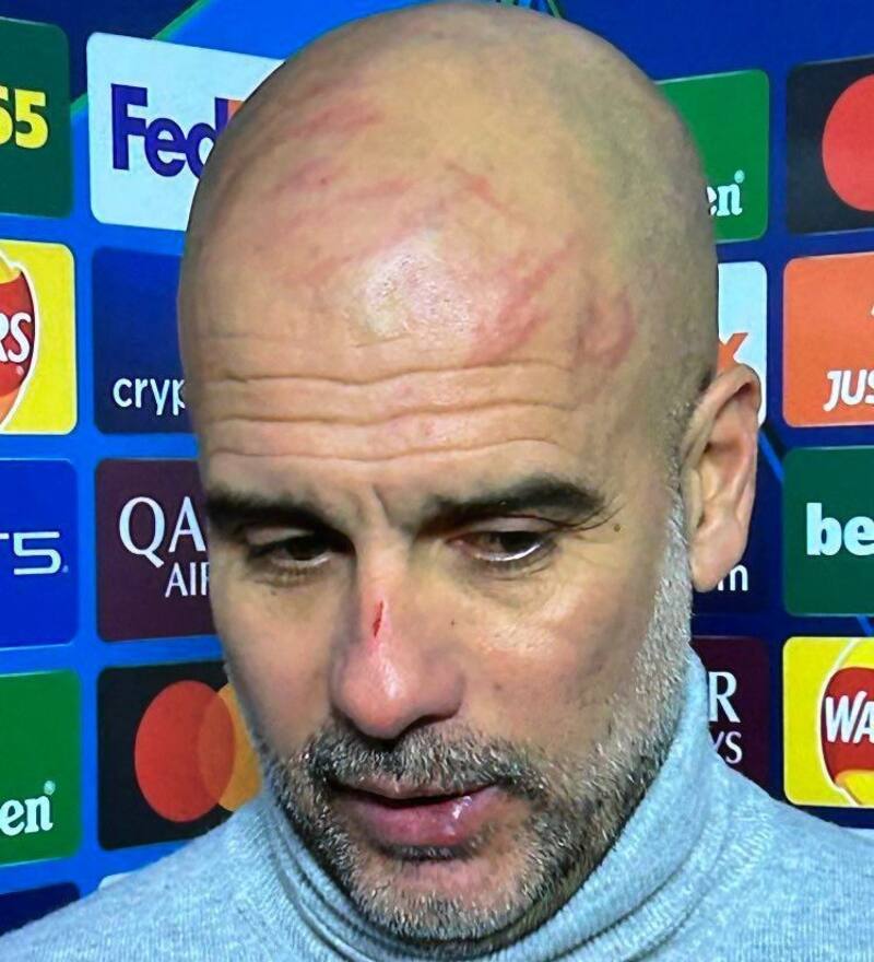 Fines de noviembre pasado: el enojo por el 3-3 ante el Feyenoord hizo que Guardiola se arañara su rostro.