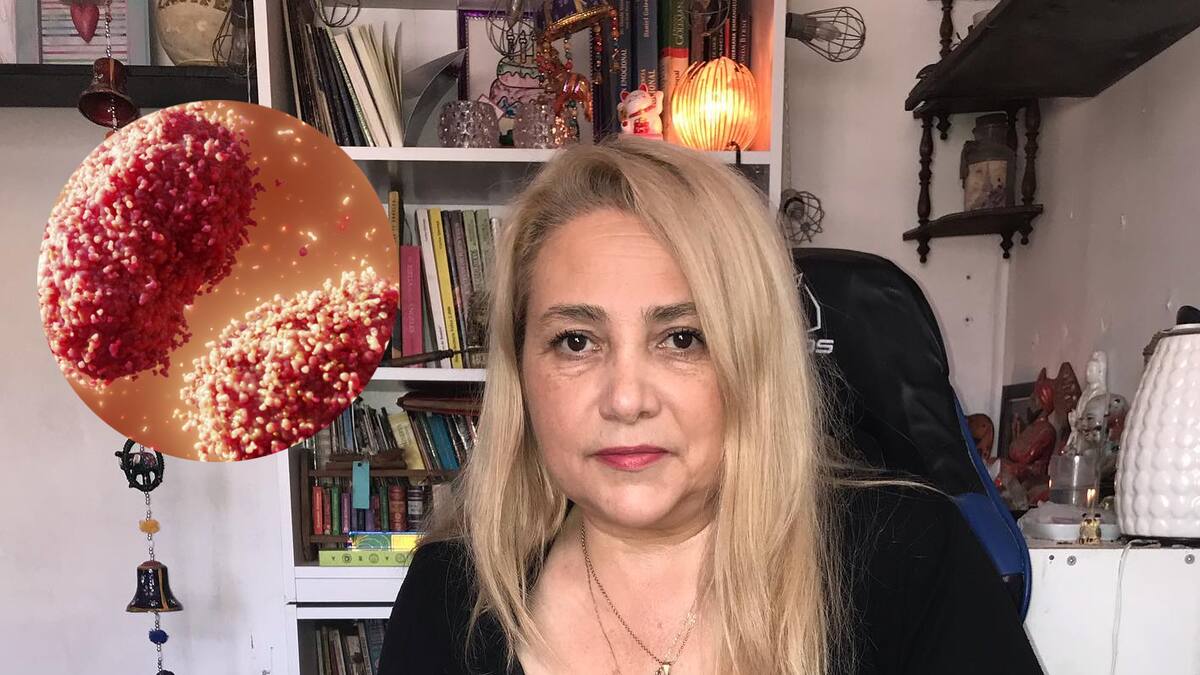 Latife Soto predice qué pasara en Chile con la Viruela del Mono