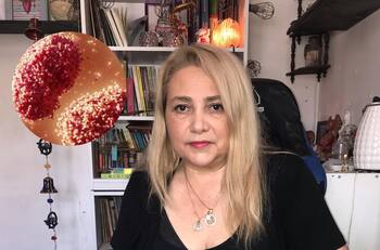 Latife Soto predice qué pasara en Chile con la Viruela del Mono