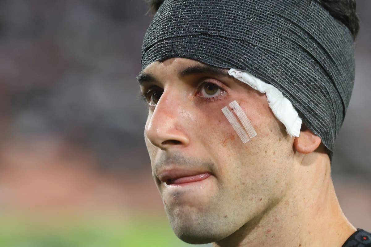 El extremo recibió un duro golpe en la Noche Alba Solidaria. Foto: Aton.