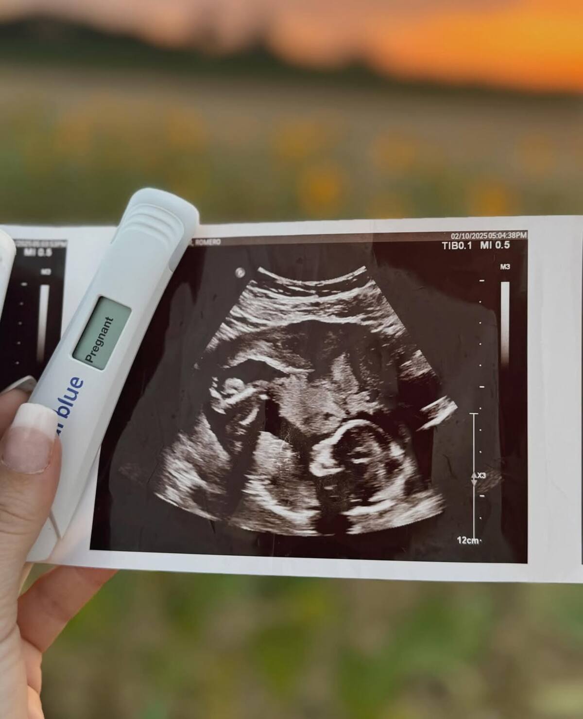 La pareja mostró la ecografía de su bebe en camino.