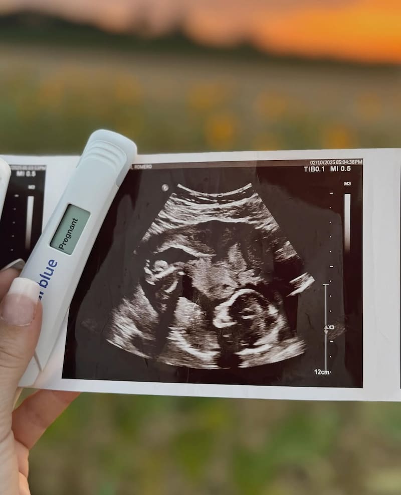 La pareja mostró la ecografía de su bebe en camino.