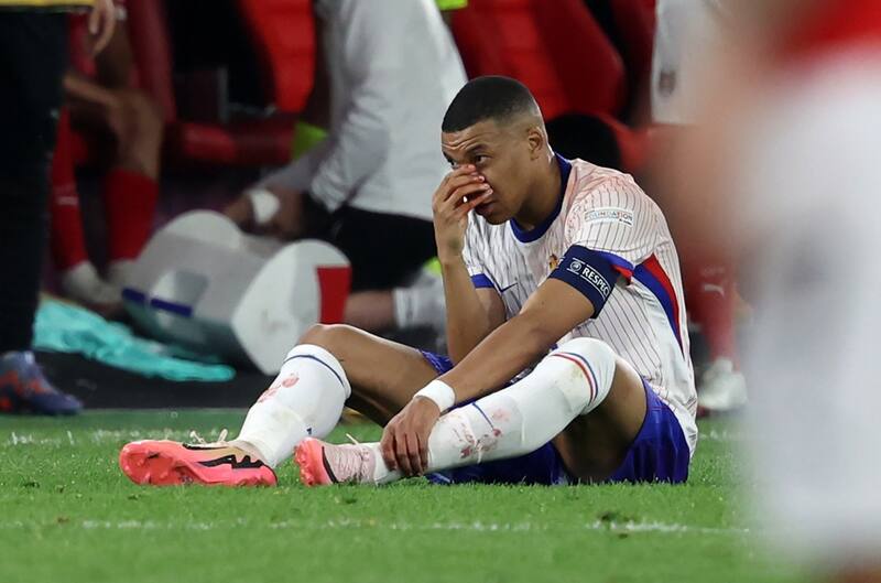 Lesión de Kylian Mbappé en la Eurocopa. EFE